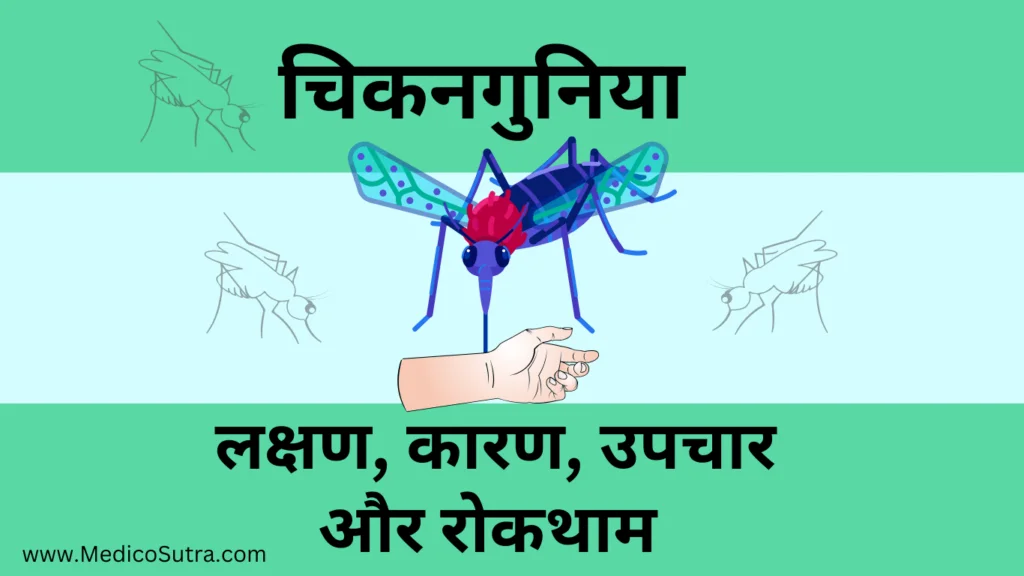 चिकनगुनिया कारण, लक्षण और उपचार