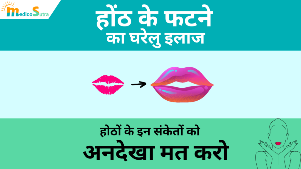 होंठ के फटने का घरेलु इलाज; होठों के इन 10 संकेतों को अनदेखा मत करो » MedicoSutra होंठ के फटने का 10 घरेलु इलाज