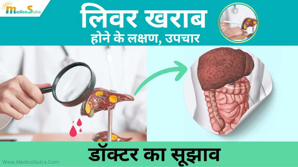 लिवर खराब होने के लक्षण और उपचार