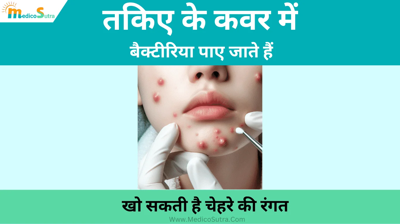 तकिए के कवर से मुंहासे का निकलना; खो सकती है चेहरे की रंगत, करें 15 घरेलू उपाय » MedicoSutra तकिए के कवर से मुंहासे का निकलना