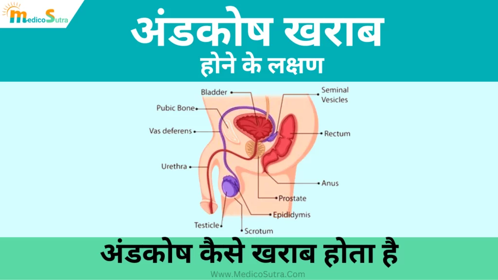 अंडकोष खराब होने के लक्षण; और सही इलाज