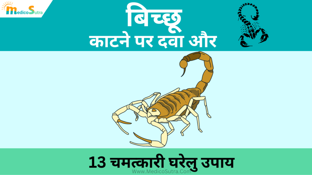 बिच्छू काटने की दवा में देरी है; तो 13 चमत्कारी घरेलु उपाय बिच्छू के जहर को तुरंत कम करेगा, Scorpion Sting Remedies » MedicoSutra बिच्छू काटने की दवा और घरेलु उपाय