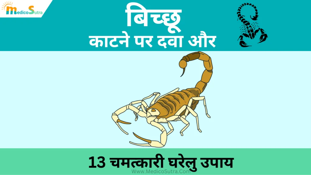 बिच्छू काटने की दवा और घरेलु उपाय