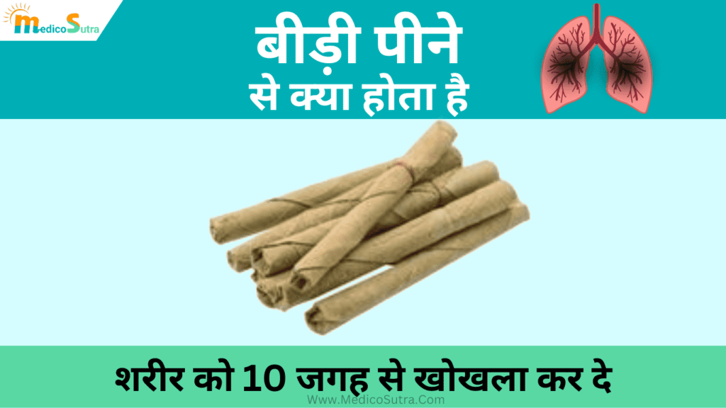 बीड़ी पीने से क्या होता है; जाने शरीर को 10 जगह से खोखला कर देने वाले बीड़ी पीने के नुकसान, Bidi Smoking » MedicoSutra बीड़ी पीने से क्या होता है; बीड़ी पीने के नुकसान