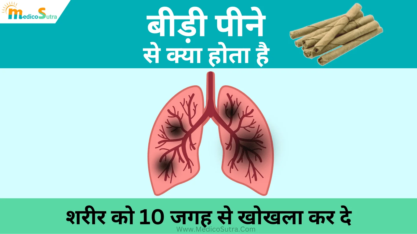 बीड़ी पीने से क्या होता है; जाने शरीर को 10 जगह से खोखला कर देने वाले बीड़ी पीने के नुकसान, Bidi Smoking » MedicoSutra बीड़ी पीने से क्या होता है; बीड़ी पीने के नुकसान