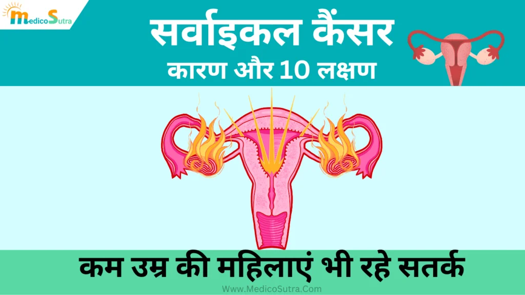 सर्वाइकल कैंसर क्या है