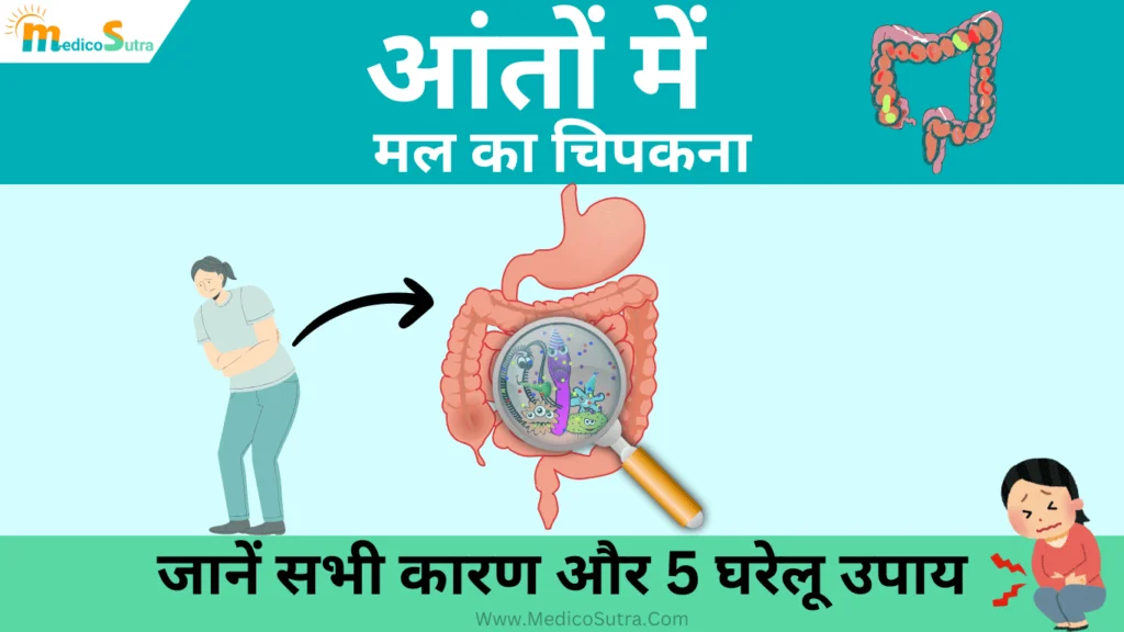 आंतों में मल का चिपकना, Aanto me mal ka chipakna