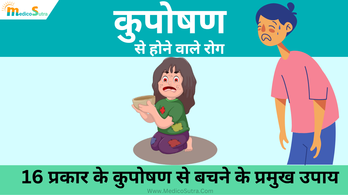 कुपोषण से होने वाले रोग, लक्षण और 16 प्रकार के कुपोषण से बचने के प्रमुख उपाय, Kuposhan se hone wale rog » MedicoSutra कुपोषण से होने वाले रोग, कुपोषण से बचने के प्रमुख उपाय