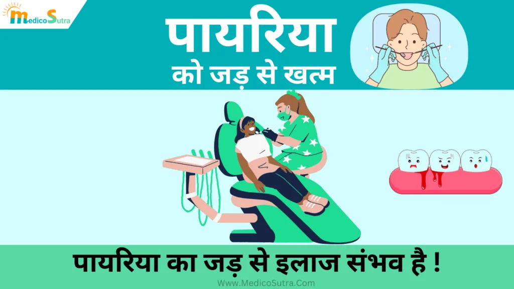 पायरिया को जड़ से खत्म करने का इलाज