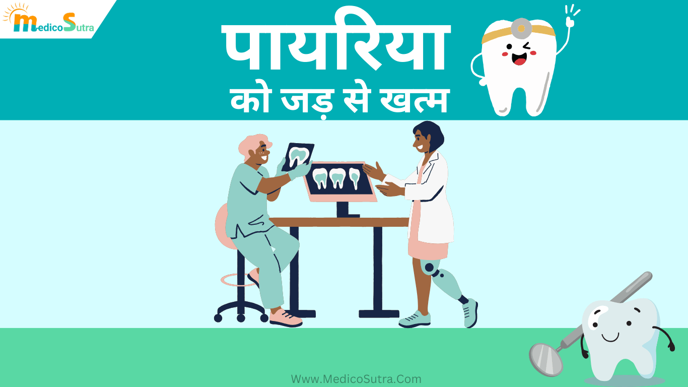 पायरिया को जड़ से खत्म करने का इलाज: 1 दिन में असर, दांत और मसूड़े मजबूत बनेंगे; Payriya » MedicoSutra पायरिया को जड़ से खत्म करने का इलाज
