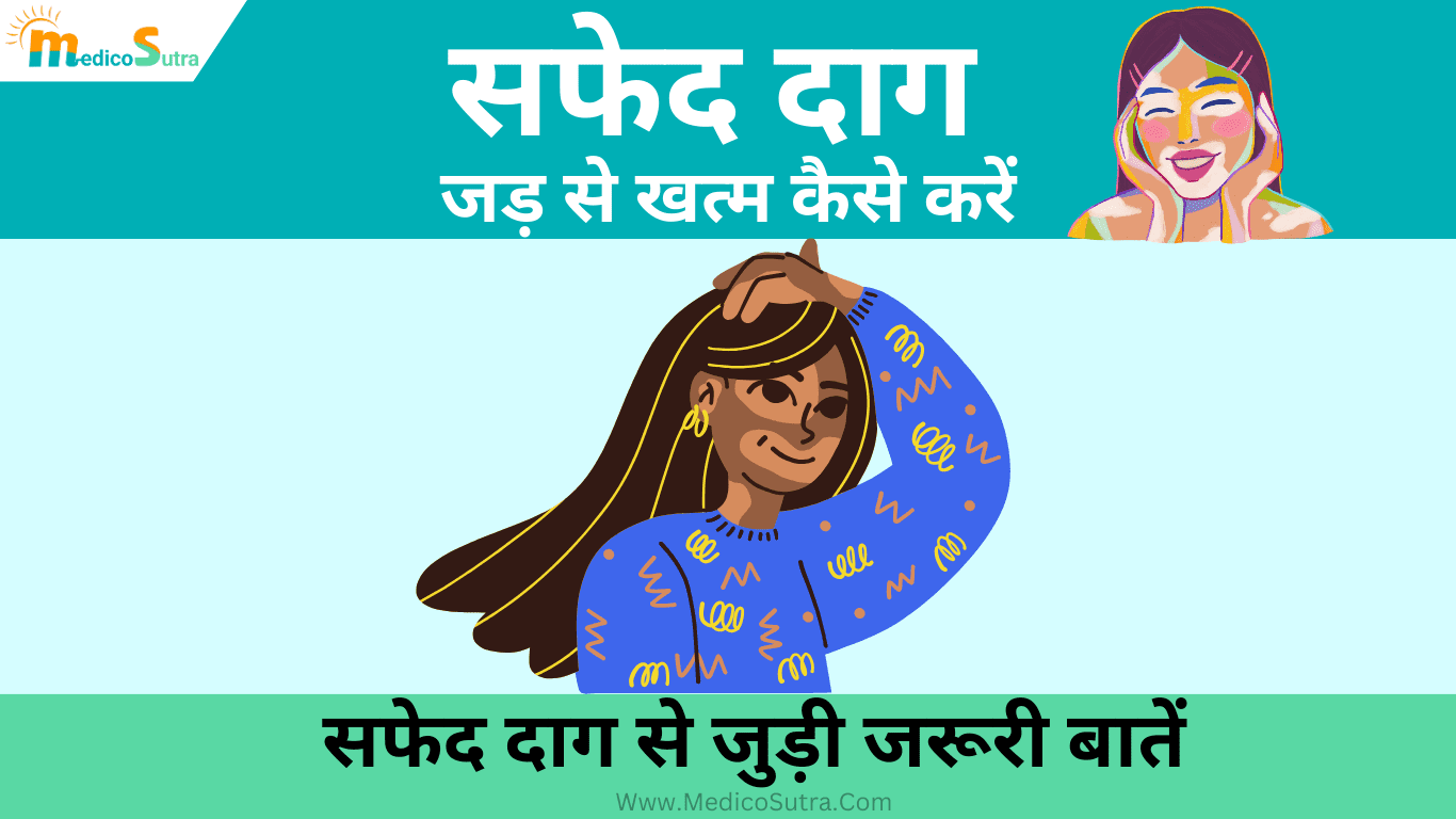 सफेद दाग को जड़ से खत्म कैसे करें; 15 चमत्कारी घरेलू उपाय और जरूरी बाते सबको पता होनी चाहिए: Vitiligo Remedies » MedicoSutra सफेद दाग को जड़ से खत्म कैसे करें