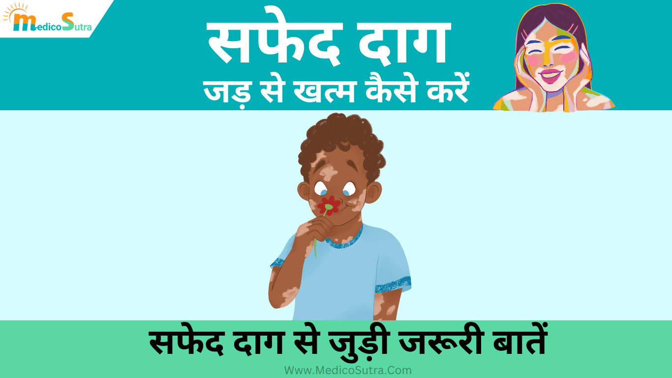 सफेद दाग को जड़ से खत्म कैसे करें; 15 चमत्कारी घरेलू उपाय और जरूरी बाते सबको पता होनी चाहिए: Vitiligo Remedies » MedicoSutra सफेद दाग को जड़ से खत्म कैसे करें