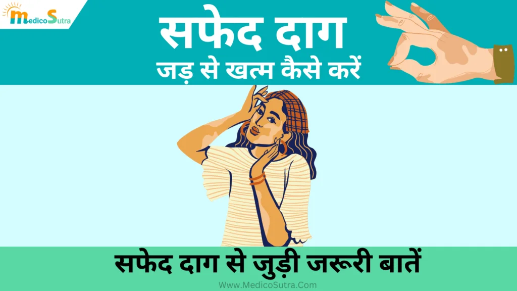 सफेद दाग को जड़ से खत्म कैसे करें
