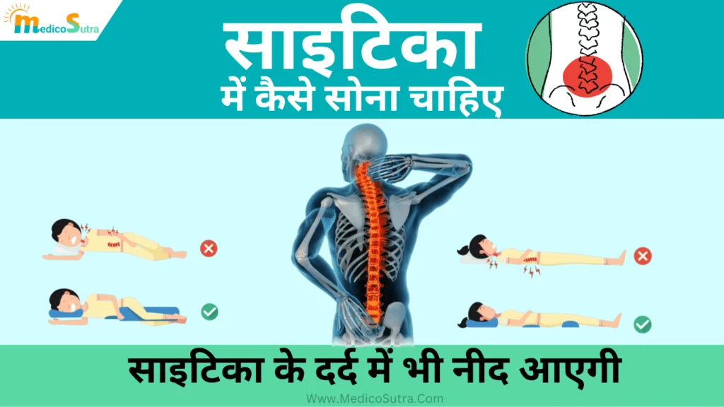 साइटिका में कैसे सोना चाहिए, Sciatica me kaise sona chahiye