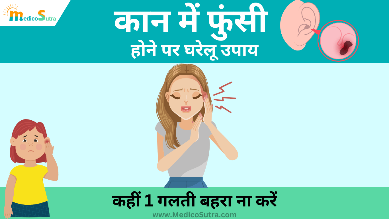 कान में फुंसी होने पर घरेलू उपाय; कहीं 1 गलती बहरा ना करें, जानें लक्षण और कान की देखभाल के उपाय » MedicoSutra कान में फुंसी होने पर घरेलू उपाय