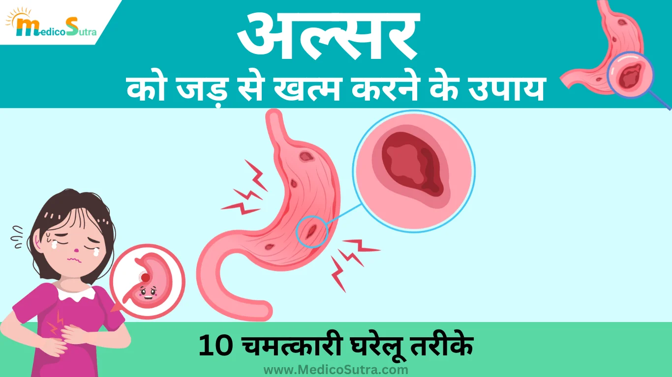 अल्सर को जड़ से खत्म करने के उपाय