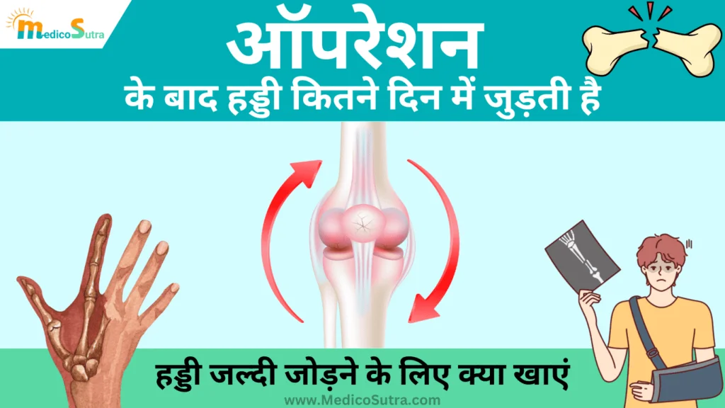 ऑपरेशन के बाद हड्डी कितने दिन में जुड़ती है