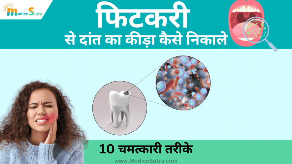 फिटकरी से दांत का कीड़ा कैसे निकाले; 10 रामबाण तरीके, पहले दिन से लाभ मिलेगा » MedicoSutra फिटकरी से दांत का कीड़ा कैसे निकाले