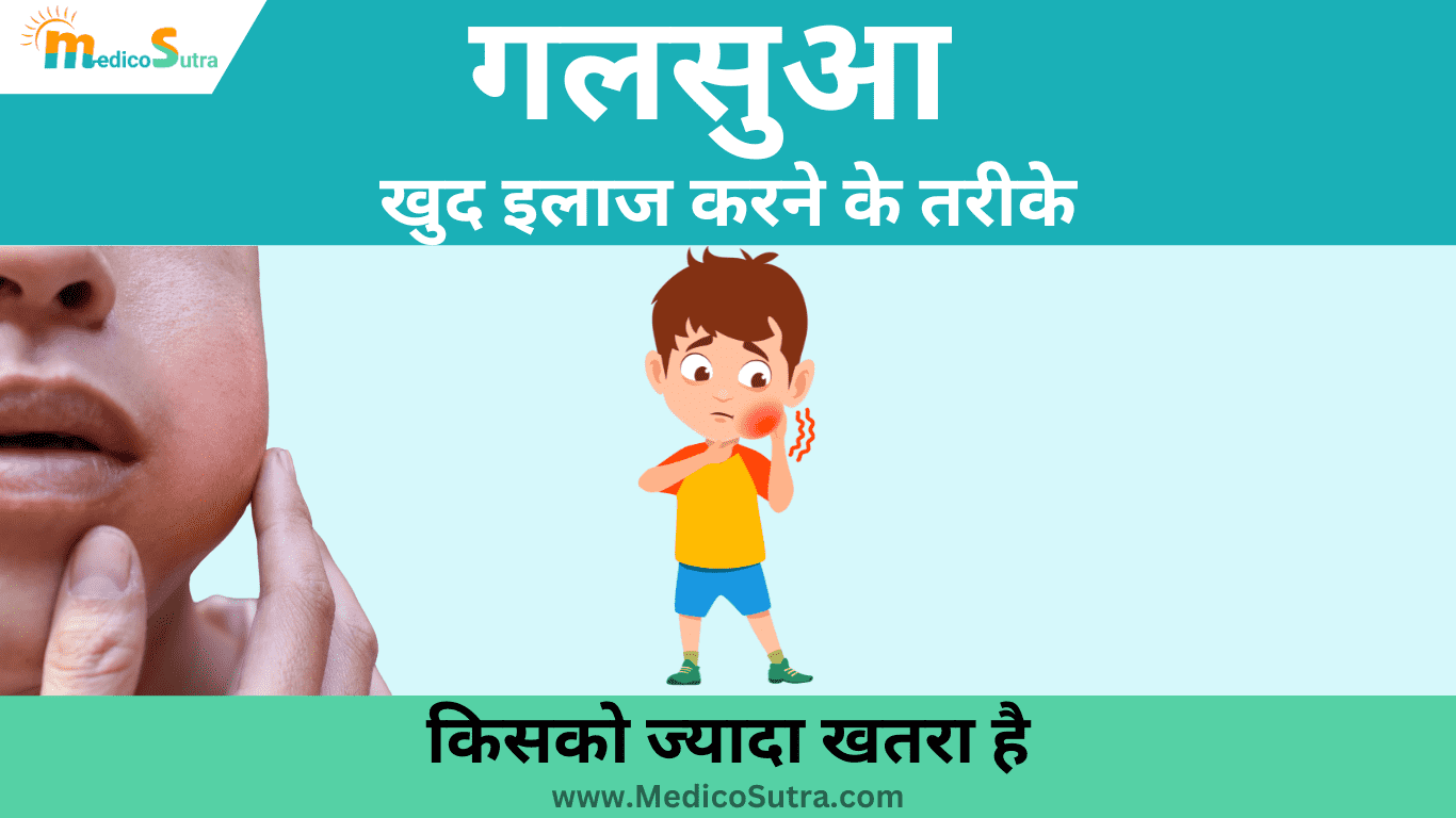 गलसुआ का खुद इलाज करने के तरीके; 10 देसी व घरेलू इलाज, और गलसुआ में क्या नहीं खाना चाहिए » MedicoSutra गलसुआ का खुद इलाज करने के तरीके