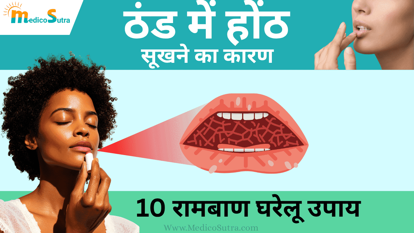 ठंड में होंठ सूखने का कारण, इलाज और 10 रामबाण घरेलू उपाय Winter Dry Lips Treatment