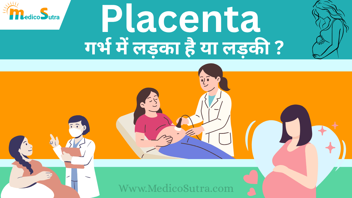 प्लेसेंटा की पोजीशन से जानें; गर्भ में लड़का है या लड़की