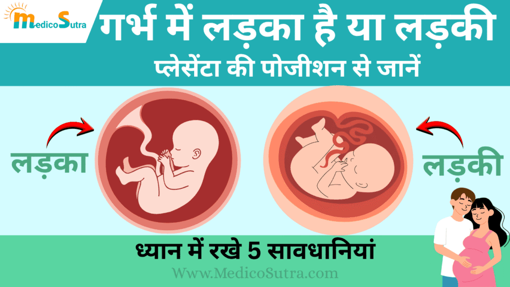 प्लेसेंटा की पोजीशन से जानें; गर्भ में लड़का है या लड़की