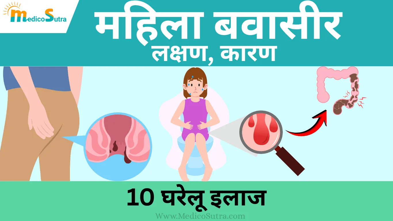 महिला बवासीर के लक्षण, कारण और 10 घरेलू इलाज ; Piles in Women Early Signs