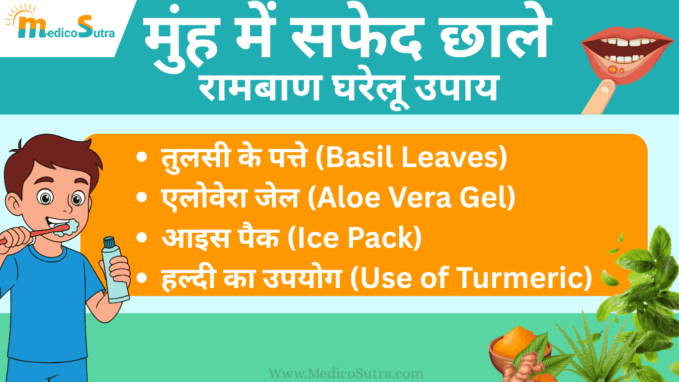 मुंह में सफेद छाले होने का कारण और 10 घरेलू उपाय; बार-बार छाले होने से रोक सकता है।
