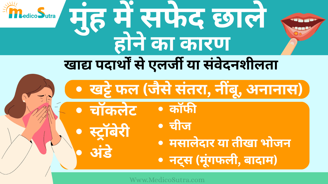 मुंह में सफेद छाले होने का कारण और 10 घरेलू उपाय; बार-बार छाले होने से रोक सकता है।