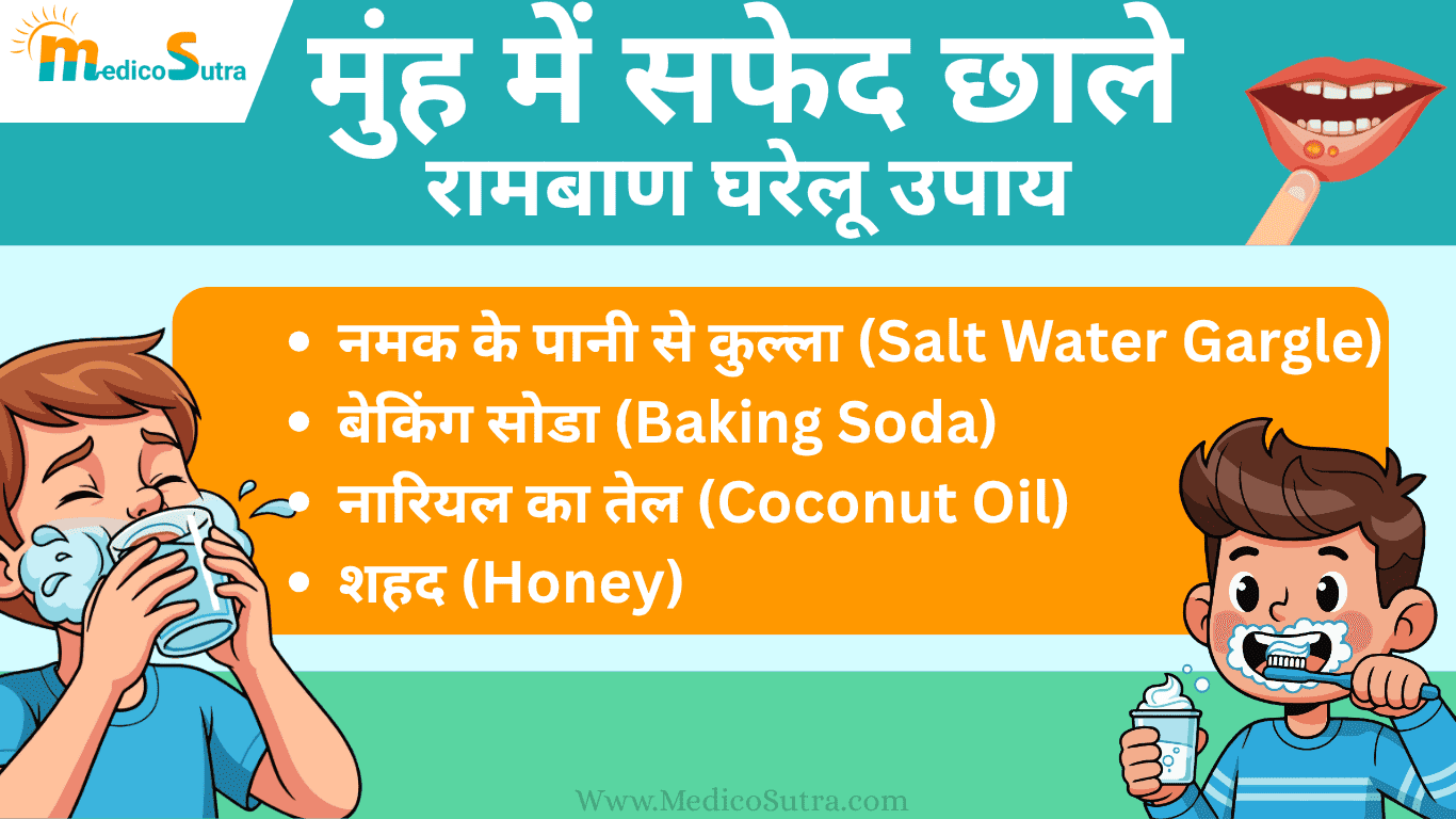 मुंह में सफेद छाले होने का कारण और 10 घरेलू उपाय; बार-बार छाले होने से रोक सकता है।